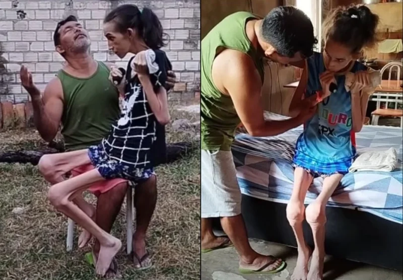 Ela perdeu os movimentos. Ele perdeu a vida que conhecia. Mas o amor deles continua lutando.