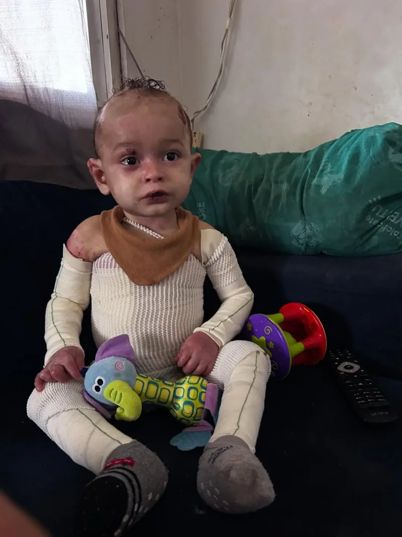 Ajude o Theo a Viver Melhor